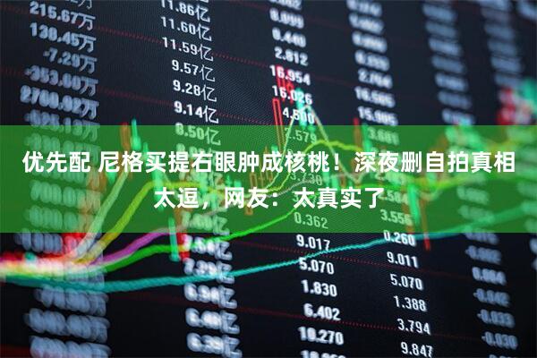 优先配 尼格买提右眼肿成核桃!深夜删自拍真相太逗,网友:太真实了